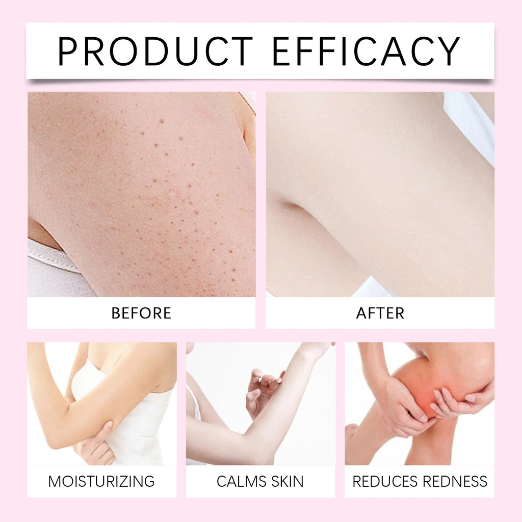 Cyperus Rotundus Oil Body Hair Remover Armpit Leg Arm Reduces Hair Growth Moisturizes Gentle Care Essential Oil for Smooth Skin